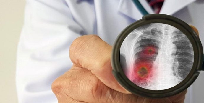 ‘Sağlıkta Türkiye Yüzyılı’ Alarm Veriyor: Özel Hastane Sayısı 22 Yılda Yüzde 103,7 Arttı