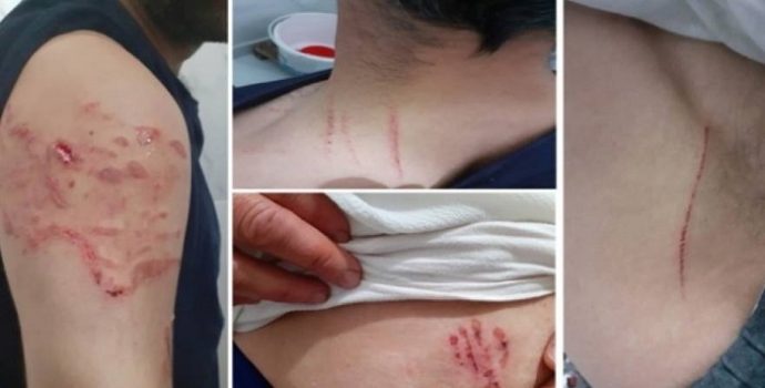 xdiyarbakirda_polislerden_bu_kez_de_kopekli_iskence_