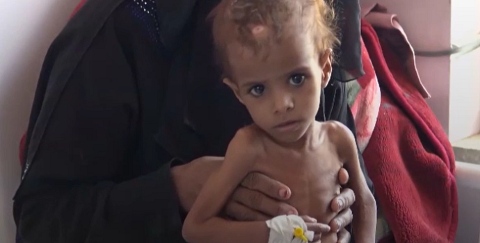 Yemen’de 12 milyon çocuğun acil yardıma ihtiyacı var