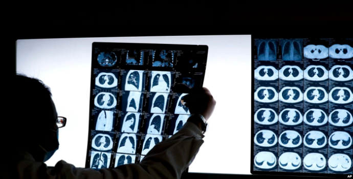 Akciğer Kanseri Tedavisinde umut veren gelişmeler