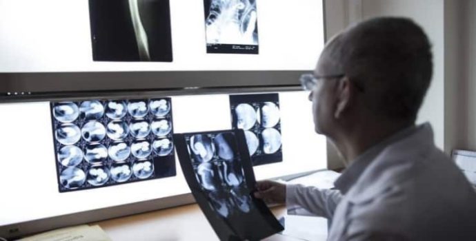 Epilepsi hastası çocuklar ilaçsız, aileler çaresiz