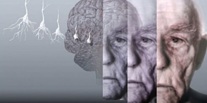 Çarpıcı araştırma: Bazı kişilik özellikleri bunama riskiyle ilişkili