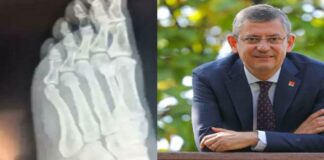 İddiaların Sonu Gelmedi Özgür Özel Röntgen Filmini Paylaştı