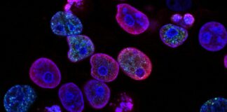 Y ve X Kuşağında Artan Kanser Riski: Araştırmadan Çarpıcı Sonuçlar purple cells