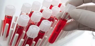 50 Yıl Sonra Yeni Bir Kan Grubu Keşfedildi: MAL