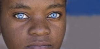 Avrupalıların Ten Renginin Evrimi: Koyu Tenin Uzun Süreli Hakimiyeti