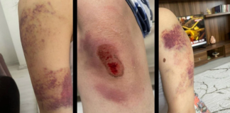 Diyarbakır’da Şiddet Mağdurlarına Çifte Mağduriyet: Hukuk Skandalı